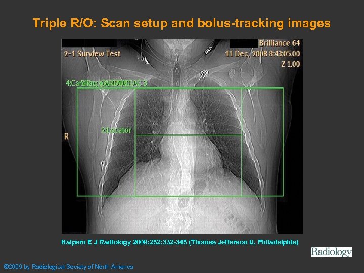 Triple R/O: Scan setup and bolus-tracking images Halpern E J Radiology 2009; 252: 332