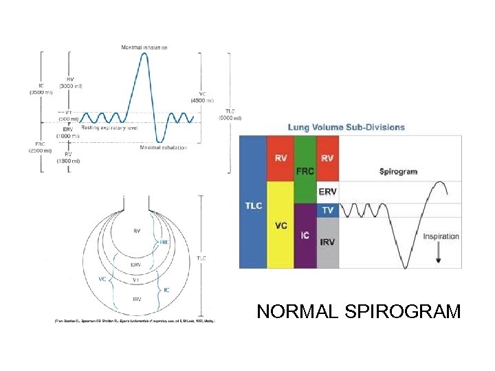 NORMAL SPIROGRAM 