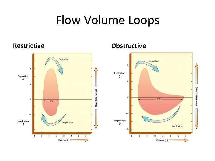 Flow Volume Loops Restrictive Obstructive 