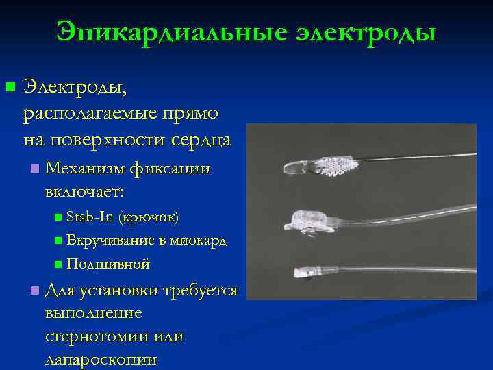 Эпикардиальные электроды n Электроды, располагаемые прямо на поверхности сердца n Механизм фиксации включает: n