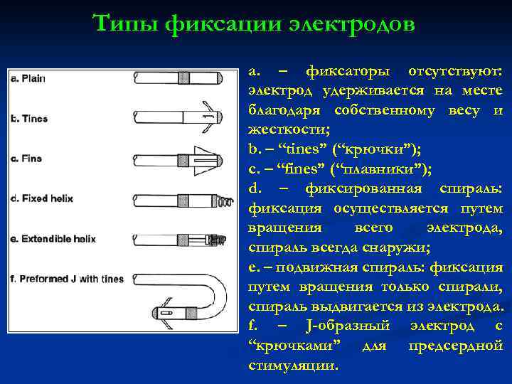 Типы фиксации электродов а. – фиксаторы отсутствуют: электрод удерживается на месте благодаря собственному весу