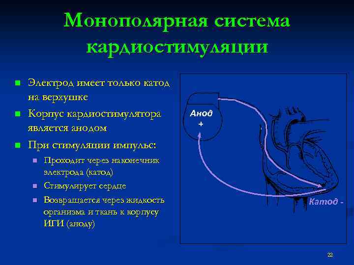 Монополярная система кардиостимуляции n n n Электрод имеет только катод на верхушке Корпус кардиостимулятора