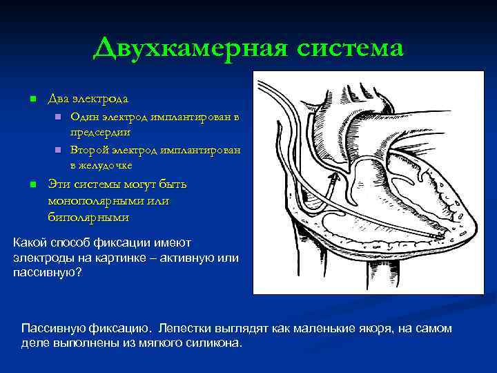 Двухкамерная система n Два электрода n n n Один электрод имплантирован в предсердии Второй