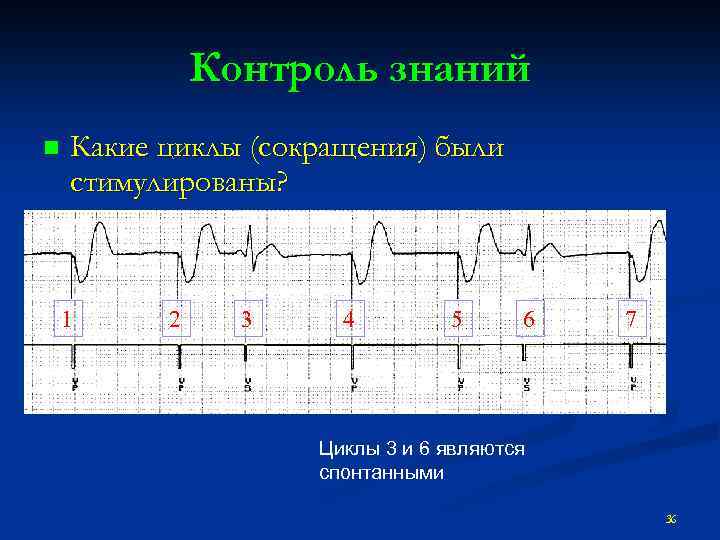 Контроль знаний n Какие циклы (сокращения) были стимулированы? 1 2 3 4 5 6