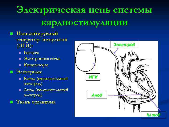 Электрическая цепь системы кардиостимуляции n Имплантируемый генератор импульсов (ИГИ): n n n Батарея Электронная