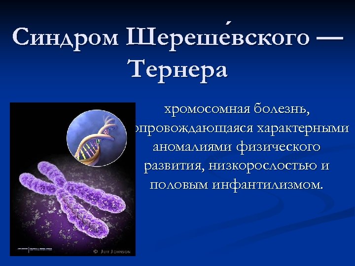 Синдром Шереше вского — вского Тернера хромосомная болезнь, сопровождающаяся характерными аномалиями физического развития, низкорослостью