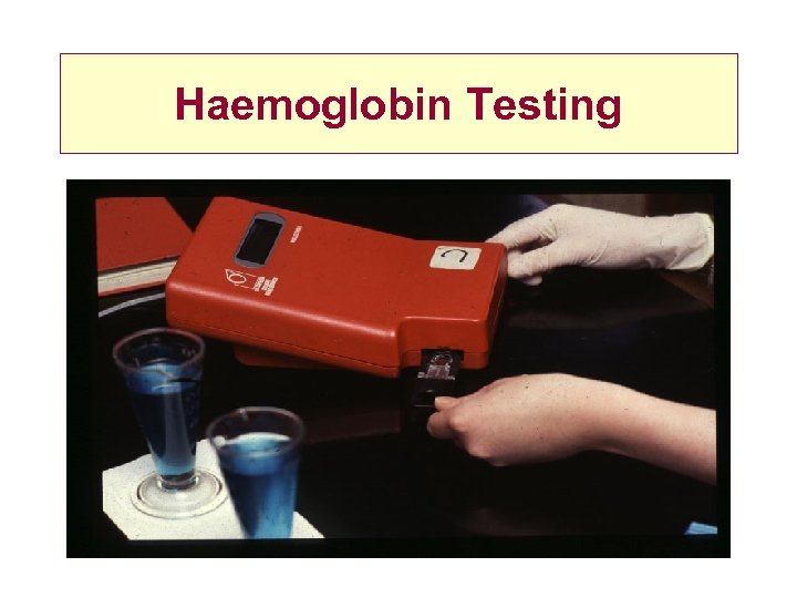 Haemoglobin Testing 