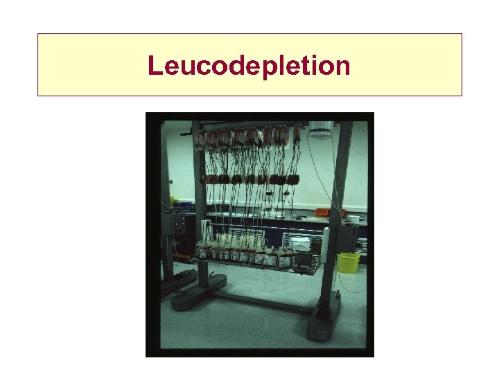 Leucodepletion 