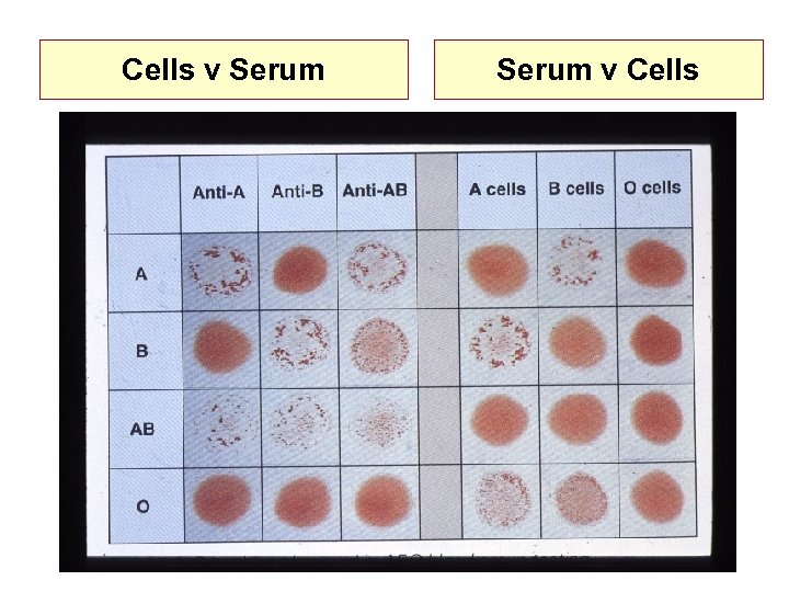 Cells v Serum v Cells 