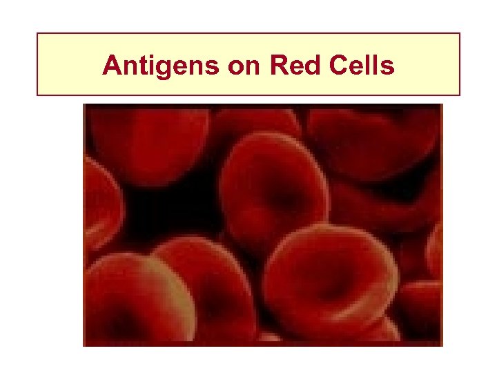 Antigens on Red Cells 