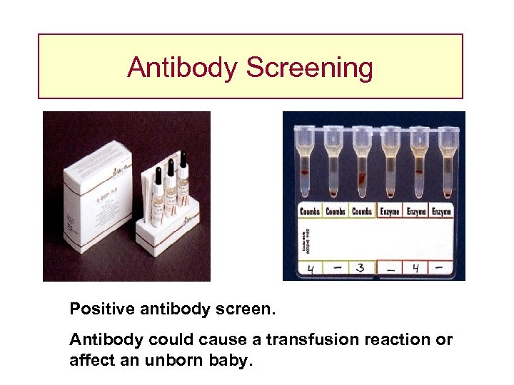 Antibody Screening Positive antibody screen. Antibody could cause a transfusion reaction or affect an