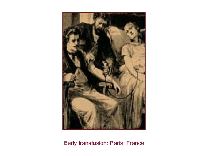 Early transfusion: Paris, France 