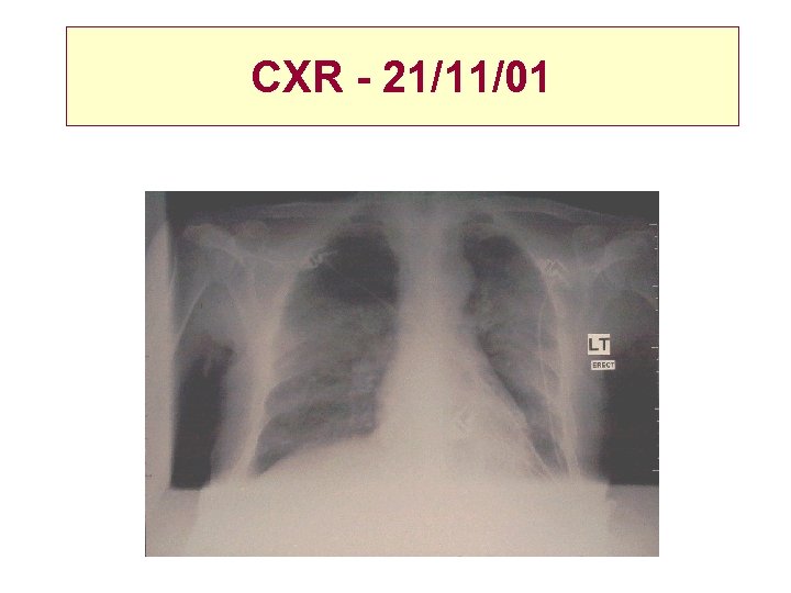 CXR - 21/11/01 