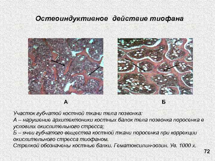 Остеоиндуктивное действие тиофана А Б Участок губчатой костной ткани тела позвонка: А – нарушение
