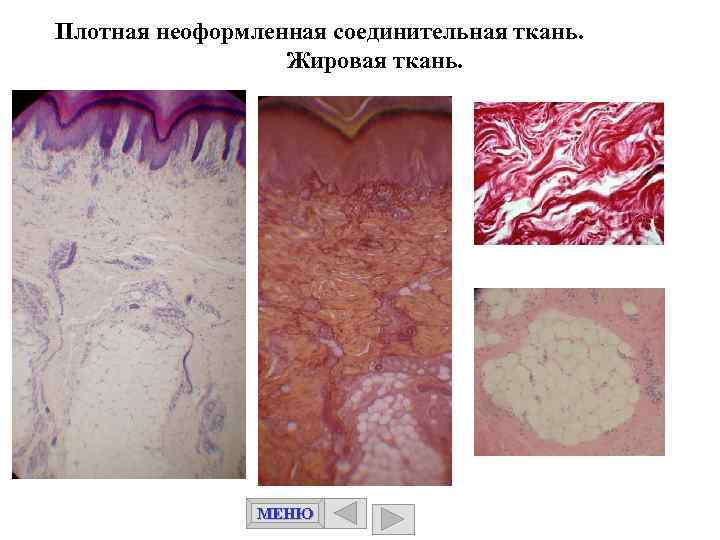 Плотная неоформленная соединительная ткань. Жировая ткань. МЕНЮ 