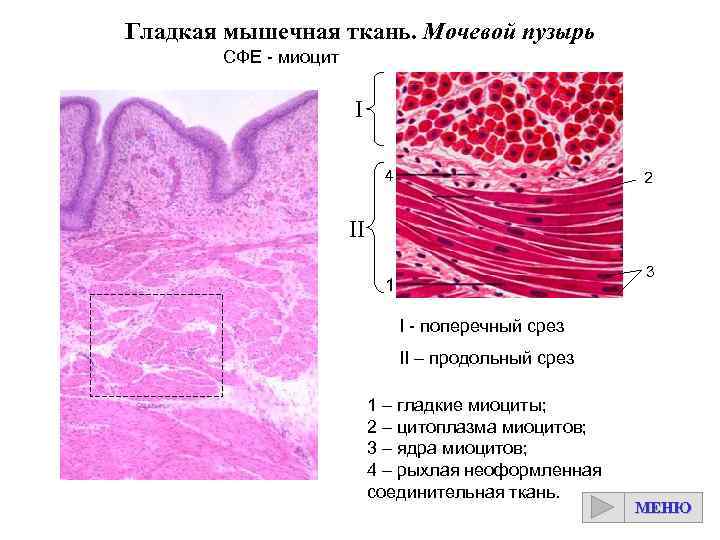 Гладкая мышечная ткань. Мочевой пузырь СФЕ - миоцит I 4 2 II 3 1