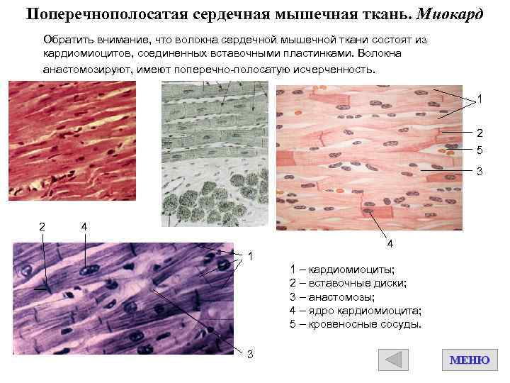 Поперечнополосатая сердечная мышечная ткань. Миокард Обратить внимание, что волокна сердечной мышечной ткани состоят из