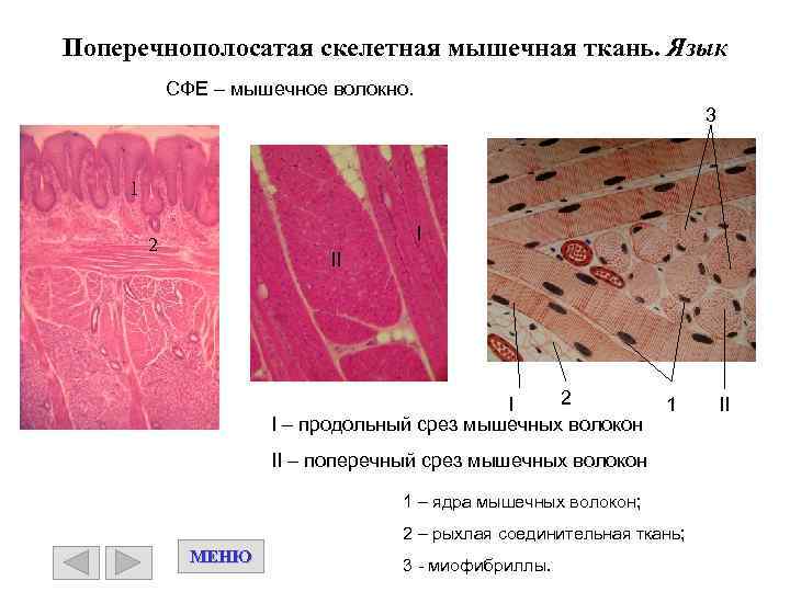 Поперечнополосатая скелетная мышечная ткань. Язык СФЕ – мышечное волокно. 3 1 I 2 I