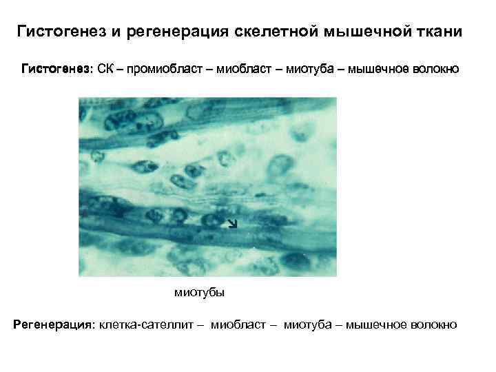 Гистогенез и регенерация скелетной мышечной ткани Гистогенез: СК – промиобласт – миотуба – мышечное