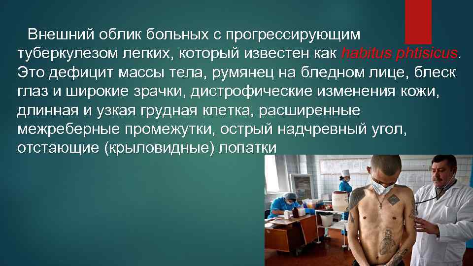 Внешний облик больных с прогрессирующим туберкулезом легких, который известен как habitus phtisicus. Это дефицит