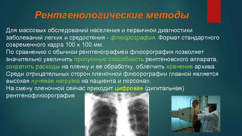 После рентгена можно делать флюорографию. Рентгенологические методы диагностики. Рентгенологические методы исследования. Рентген флюорография. Флюорография методика.