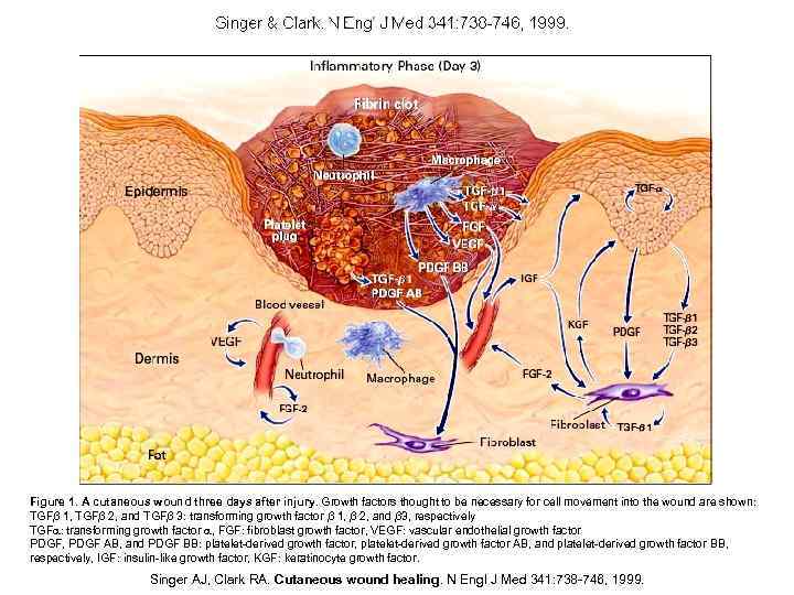 Figure 1. A cutaneous wound three days after injury. Growth factors thought to be