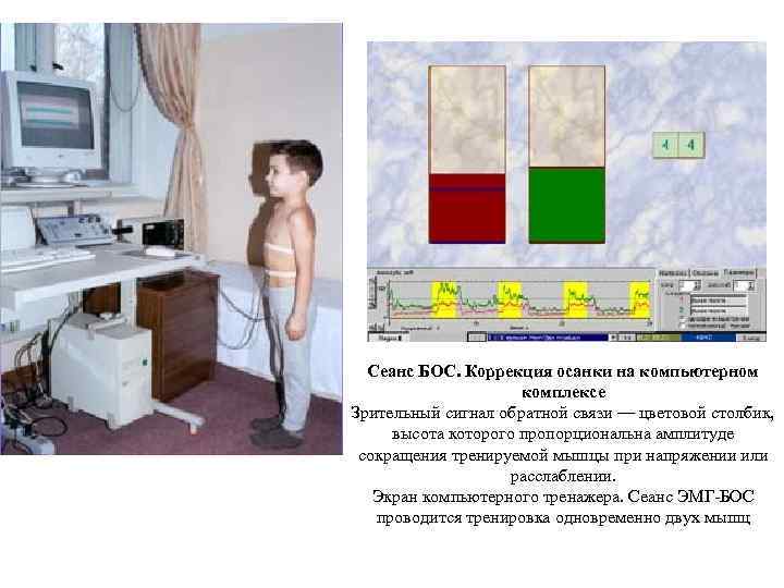 Сеанс БОС. Коррекция осанки на компьютерном комплексе Зрительный сигнал обратной связи — цветовой столбик,