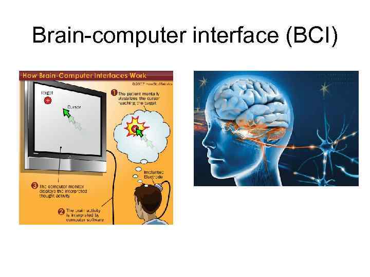 Brain-computer interface (BCI) 