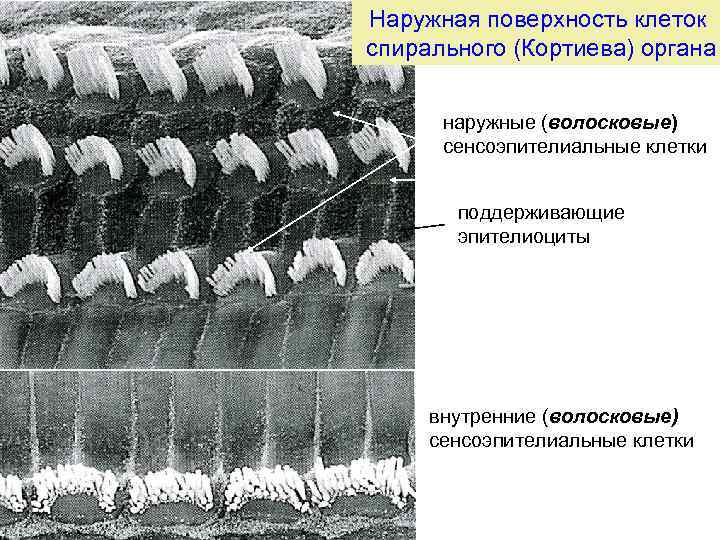 Наружная поверхность клеток спирального (Кортиева) органа наружные (волосковые) сенсоэпителиальные клетки поддерживающие эпителиоциты внутренние (волосковые)