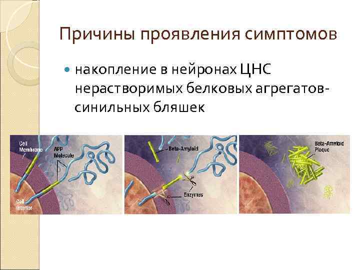 Причины проявления симптомов накопление в нейронах ЦНС нерастворимых белковых агрегатовсинильных бляшек 