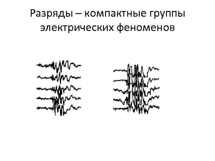 Разряды – компактные группы электрических феноменов 