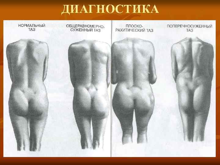 ДИАГНОСТИКА 