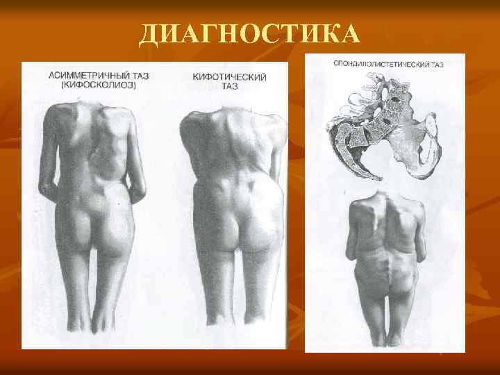 ДИАГНОСТИКА 