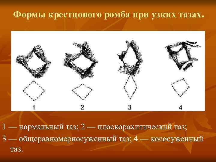 Таз в розыске прохождение