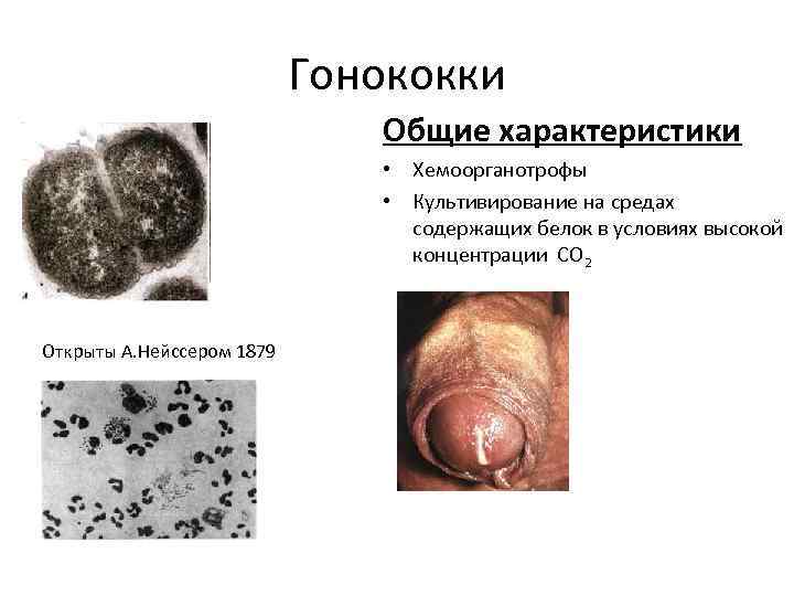 Гонококки Общие характеристики • Хемоорганотрофы • Культивирование на средах содержащих белок в условиях высокой