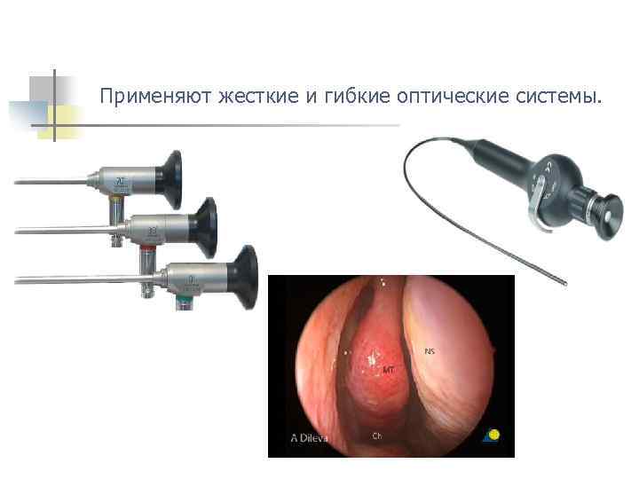  Применяют жесткие и гибкие оптические системы. 