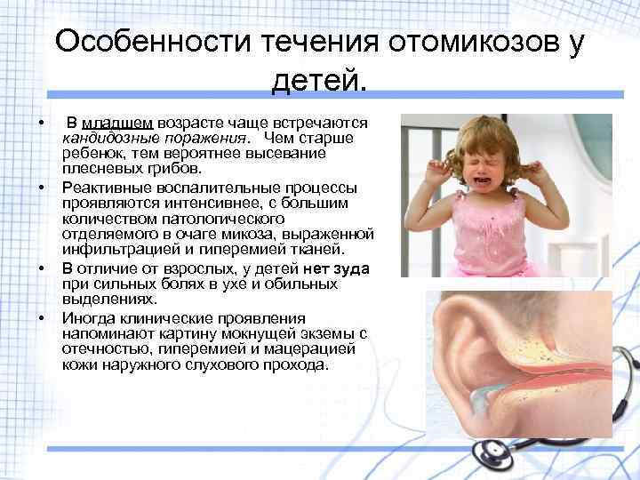 Особенности течения отомикозов у детей. • • В младшем возрасте чаще встречаются кандидозные поражения.