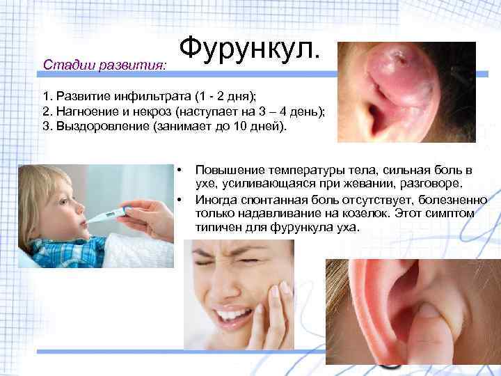Стадии развития: Фурункул. 1. Развитие инфильтрата (1 - 2 дня); 2. Нагноение и некроз