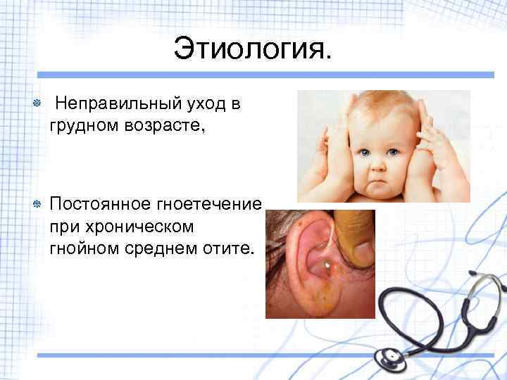 Этиология. Неправильный уход в грудном возрасте, Постоянное гноетечение при хроническом гнойном среднем отите. 