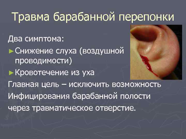 Травма барабанной перепонки Два симптома: ► Снижение слуха (воздушной проводимости) ► Кровотечение из уха