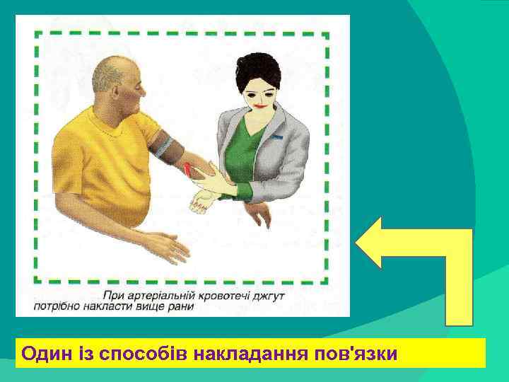 stack trace: Один із способів накладання пов'язки 