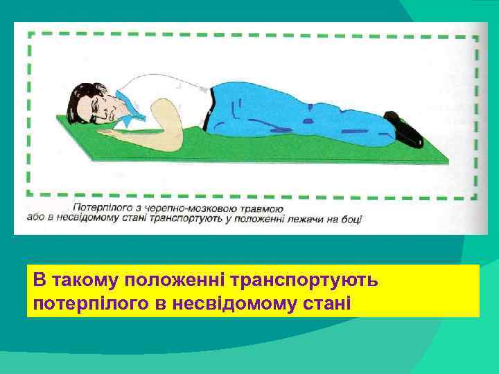stack trace: В такому положенні транспортують потерпілого в несвідомому стані 