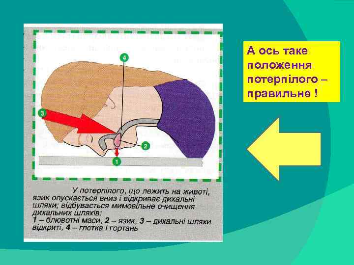 А ось таке положення потерпілого – правильне ! stack trace: 