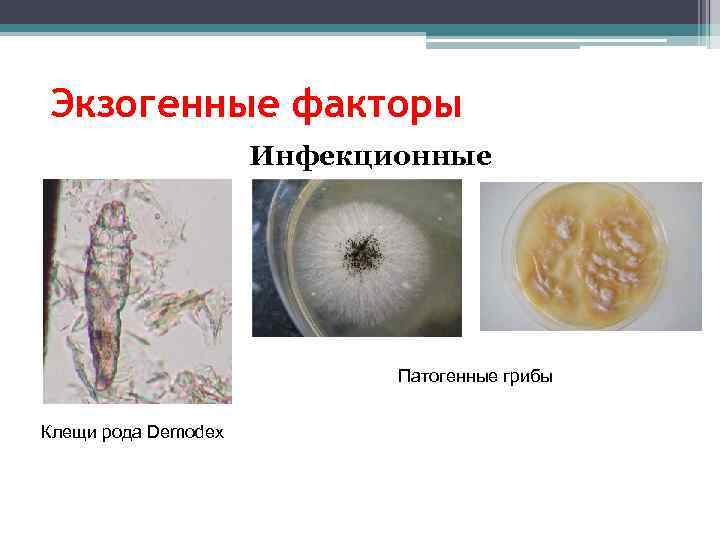 Экзогенные факторы Инфекционные Патогенные грибы Клещи рода Demodex 