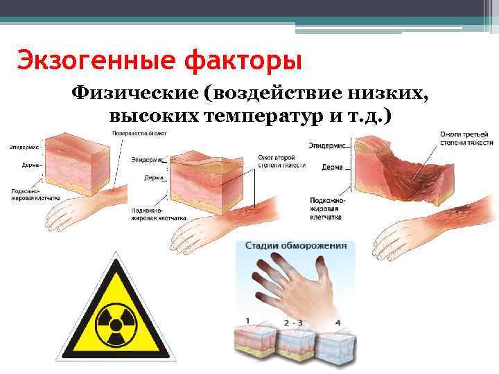 Экзогенные факторы Физические (воздействие низких, высоких температур и т. д. ) 