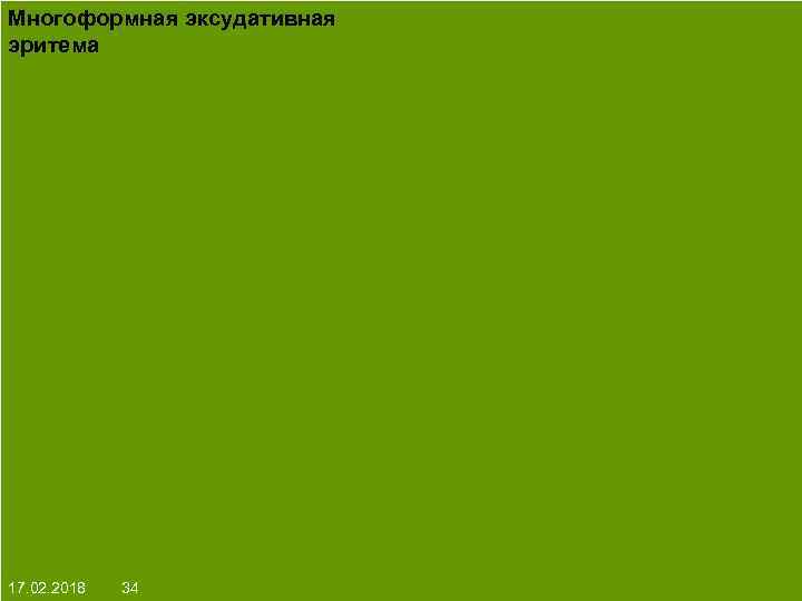 Многоформная эксудативная эритема На протяжении многих десятков лет менялось представление о влияние ультрафиолета на