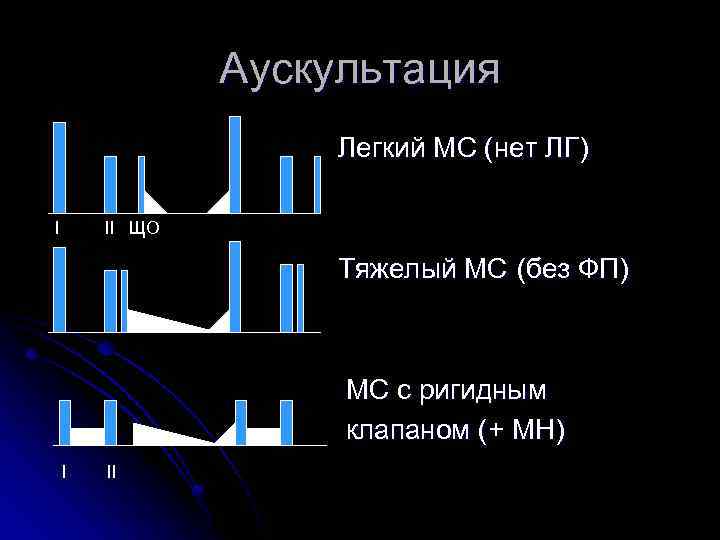 Аускультация Легкий МС (нет ЛГ) I II ЩО Тяжелый МС (без ФП) МС с
