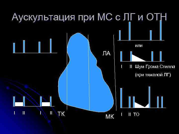 Аускультация при МС с ЛГ и ОТН или ЛА I II Шум Грэма Стилла