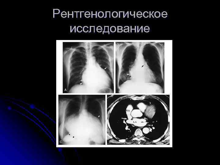 Рентгенологическое исследование 
