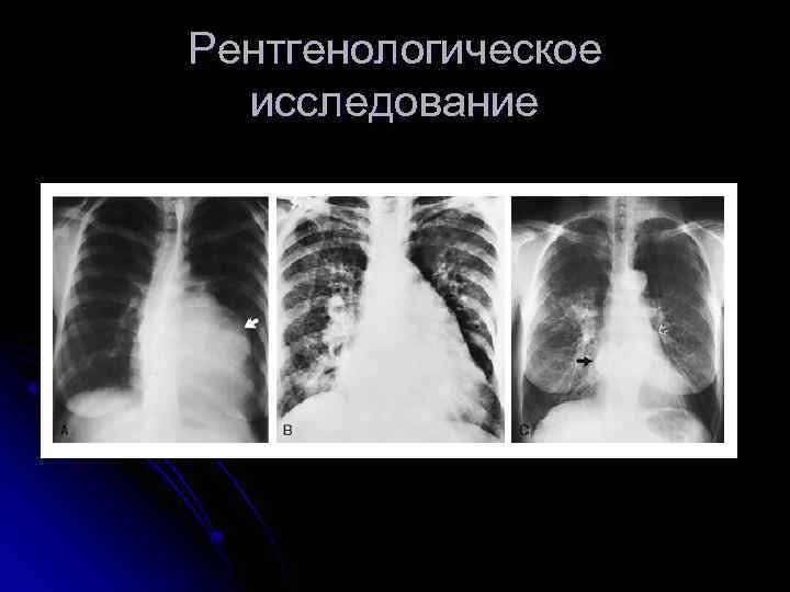 Рентгенологическое исследование 